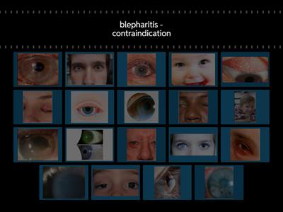 Slide Identification