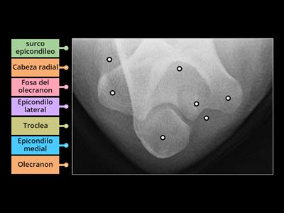 Anatomia rx proyeccion de olecranon