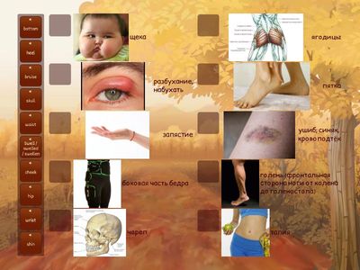 Solutions intermediate 3A