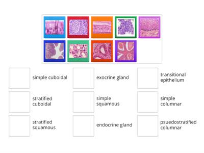 epithelial tissues matching pictures