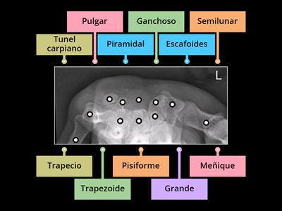 Anatomia rx muñeca tunel carpiano
