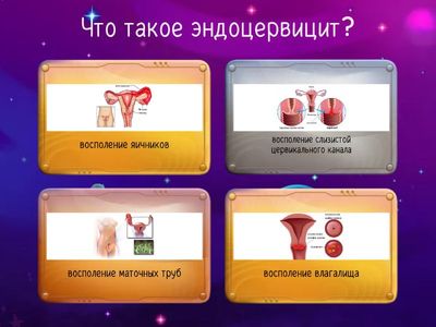 Эндоцервицит 