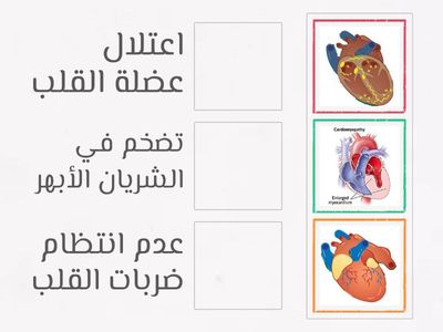 أمراض القلب والأوعية الدموية