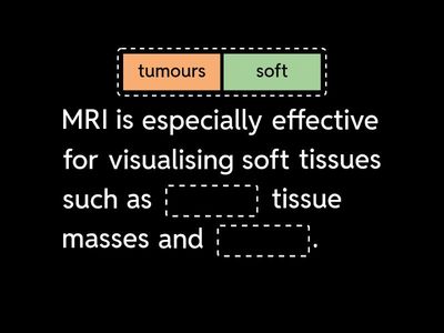MRI Imaging – Complete the Sentences