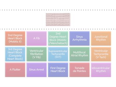 Cardiac Rhythm Identification