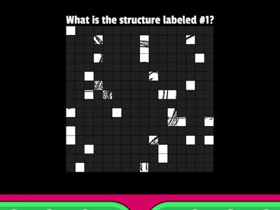 Label the Pregnancy Structures