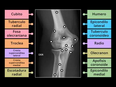 Anatomia rx codo ap