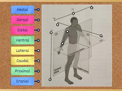 Anatomical Planes: Label