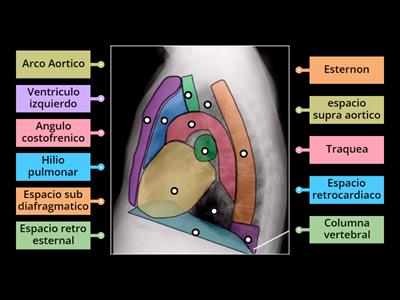 Anatomia de Rx Torax lateral