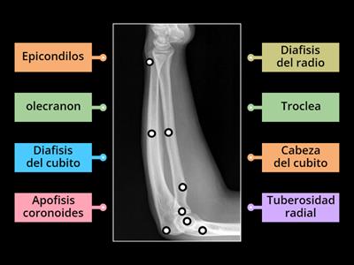 Anatomia rx antebrazo lateral