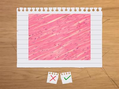 Different types of muscle tissue