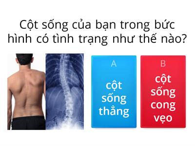 Phòng tránh cong vẹo cột sống - TN&XH 2 sgk Cánh Diều