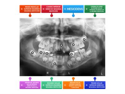 RADIOGRAFÍA PANORÁMICA NIÑO 8 AÑOS