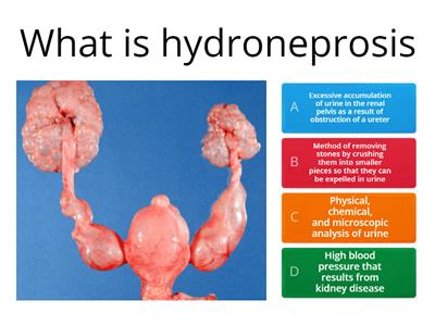 Nursing 1110 Urinary