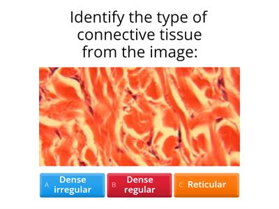 Dense and Loose Connective Tissue