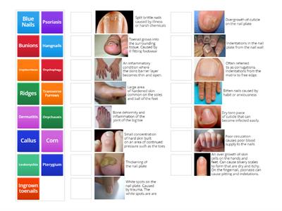 Manicure & Pedicure - Common Conditions