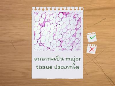วัดกันหน่อยวัยรุ่น Epithelial tissue and Cionnective tissue