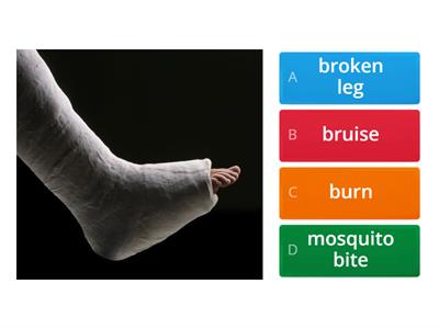 EC A2 | Injuries