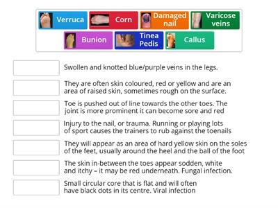 Pedicure contra indications