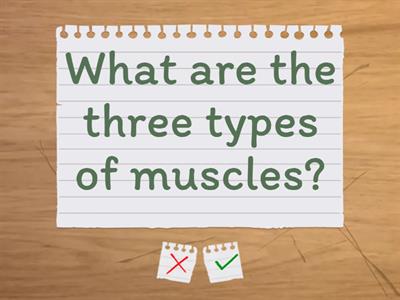 Muscle:  Types of Muscle