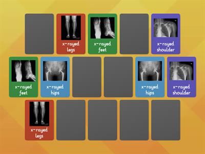 MJwJ Ep 8 L3 x-rayed body parts