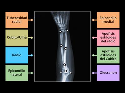 Anatomia Rx antebrazo ap