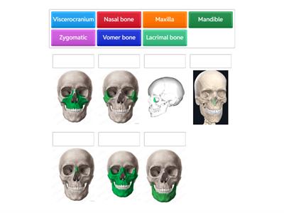 Facial bones