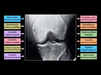 Anatomia rx tunel intercondilio rodilla