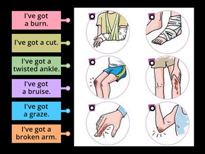 JE5:  Injuries