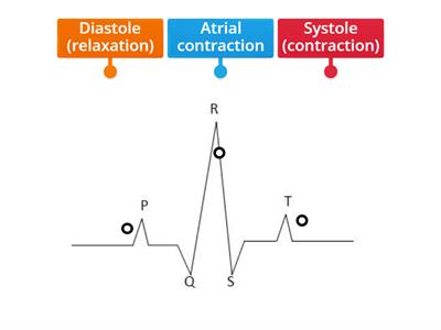 ECG