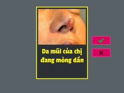 L73 - LUYỆN NÓI - TƯ VẤN CHỈNH SỬA MŨI 