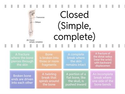 Common Fractures Matching