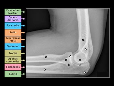 Anatomia Rx Codo lateral