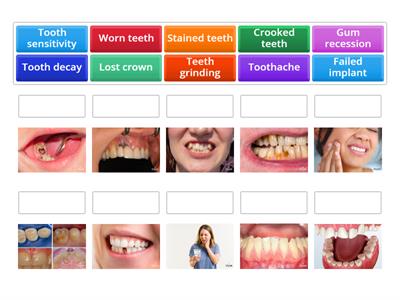Top dental problems-Vocabulary