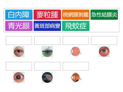 視力疾病配對