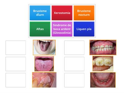 Manifestacions bucals directes