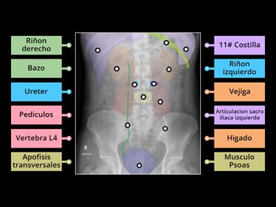 Rx abdomen anatomia