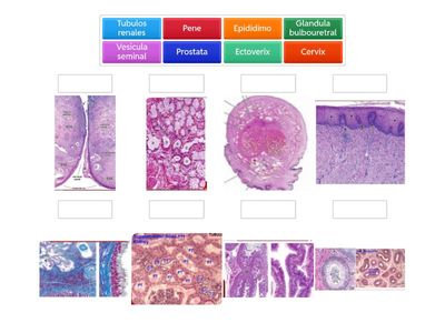 Identifica estructuras histologicas sis genitourinario