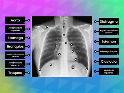 anatomia de Rx torax PA