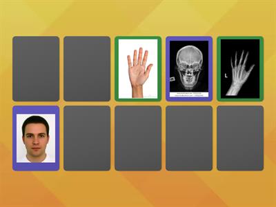 X-ray and Body parts