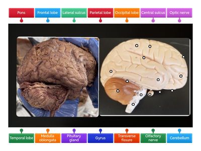 Lateral view of brain