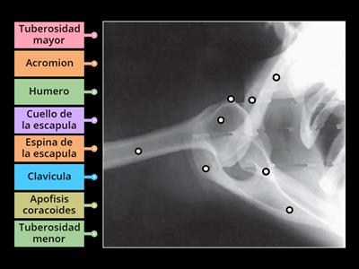 Anatomia rx hombro axial superoinferior