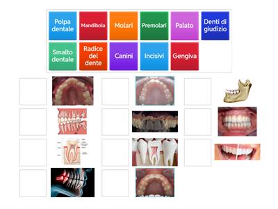 Dentista (parte della bocca)