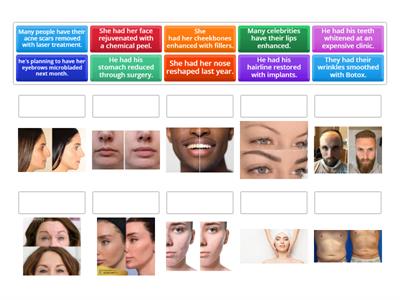 Have something done - Cosmetic surgery