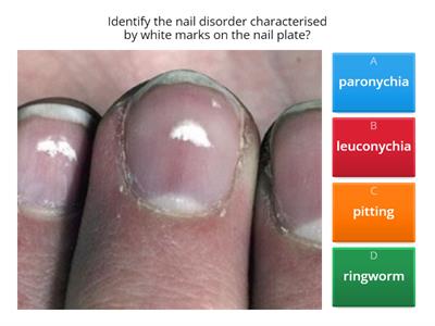 VTCT Nail and skin disorders