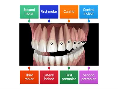 Tooth notation